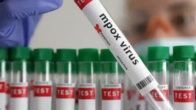 hastaneden aciklama geldi ilk vaka tespit edildi hem hayvandan hem insandan bulasiyor nMrU8L9J.webp