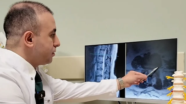 Bel Fıtığı Hakkında Önemli Bilgiler: Ameliyat Son Çare Olmalı